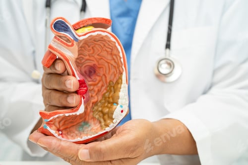 Preview: Stomach disease, doctor with anatomy model for study diagnosis and treatment in hospital.