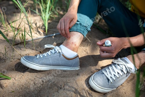 Preview: First aid for mosquito bites. Cropped man treat insect bites on ankles with soothing balm in nature