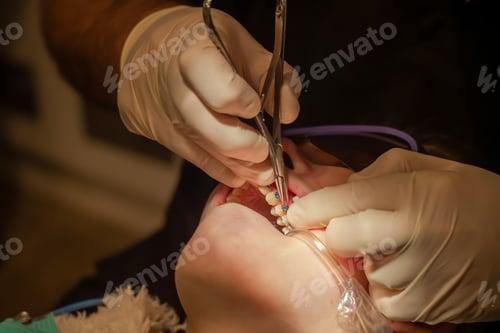 Preview: Orthodontist put on metal braces. Orthodontic treatment. Bonding braces