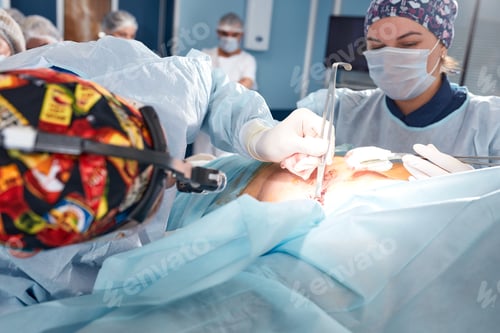 Preview: Operating Room Team Performing Surgery Procedures