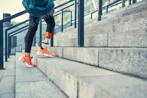 Preview: Sport is my way of life. Cropped photo of woman with leg prosthesis in sports clothing carrying her