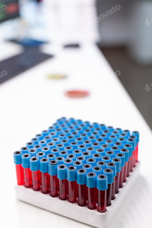 Preview: Vacutainer tubes for collecting blood samples during biological chemistry examination