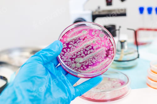 Preview: Examine bacteria in petri dishes in the laboratory. Selective focus.