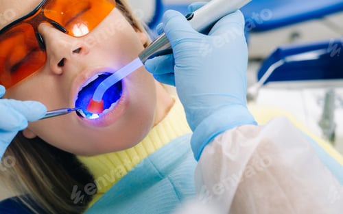 Preview: A young beautiful girl in dental glasses treats her teeth at the dentist with ultraviolet light