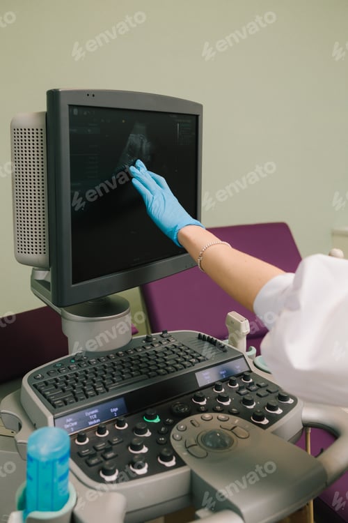 Preview: Pregnant patient receives ultrasound assessment for embryo health in hospital