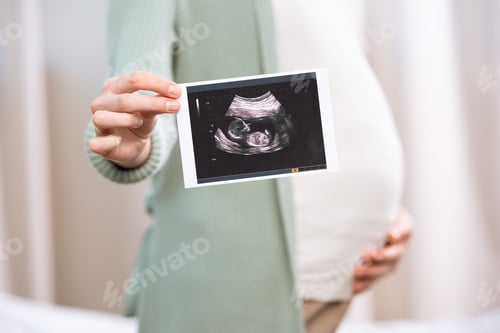 Preview: Pregnant woman holding ultrasound scan of baby and touching belly