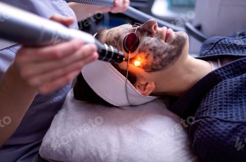 Preview: Beautician holding beauty laser near woman face covered with carbon mask