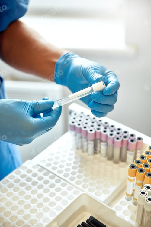 Preview: Skilled Laboratory Technician Expertly Handling Blood Test Tubes with Precision and Care
