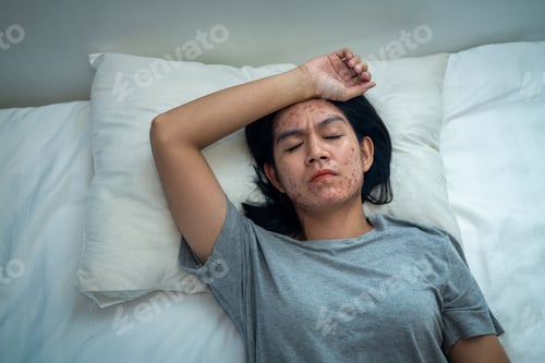Preview: Acne on face because the disorders of sebaceous glands productions. Acne or a Cosmetic Allergy.