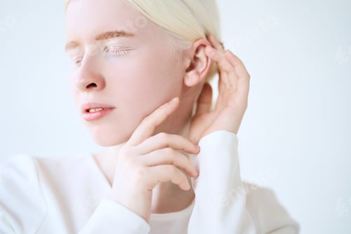 Preview: Albino girl model on white studio background. Inclusive woman portrait.