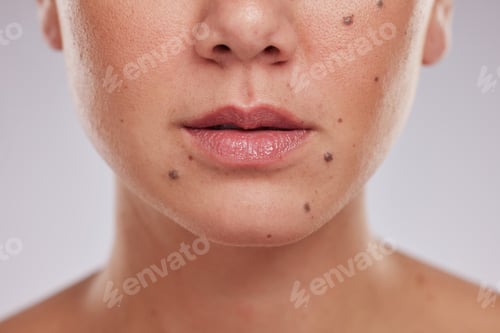 Preview: Lips, mouth and woman, face and beauty with closeup, skincare and lip filler with collagen on studi
