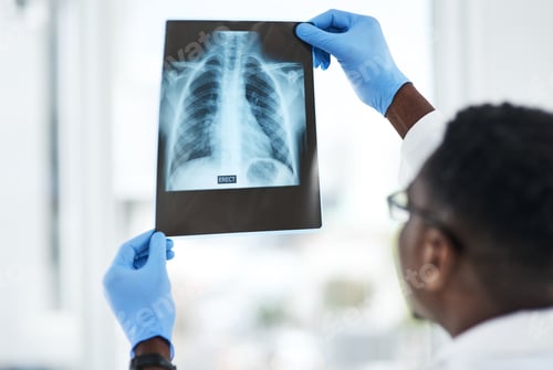 Preview: Shot of a young doctor analysing an x ray of a patients chest