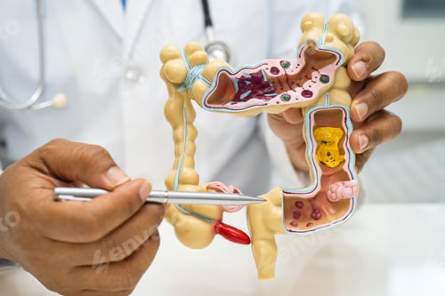 Preview: Intestine, appendix and digestive system, doctor holding anatomy model for study diagnosis