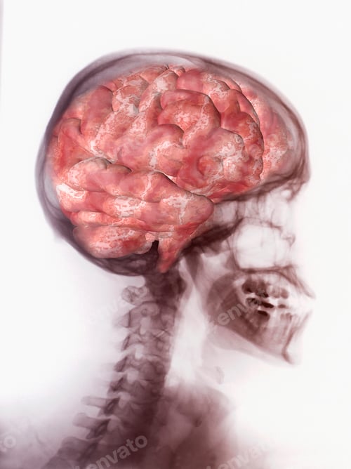 Preview: Illustration of the human brain superimposed over an x-ray of the skull