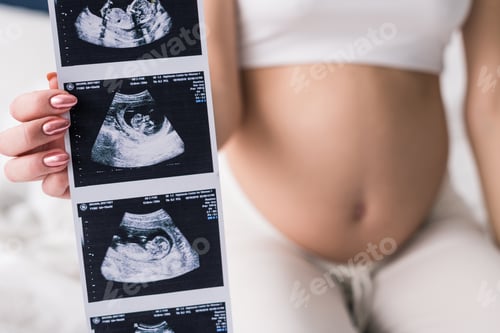 Preview: Cropped view of pregnant woman showing ultrasound scans