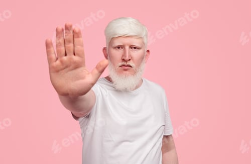 Preview: Albino man gesturing stop to camera