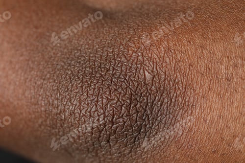 Preview: Macro view of normal skin as background
