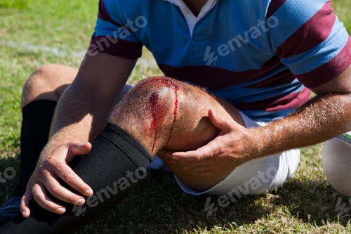 Preview: Mid section of rugby player with injured knee