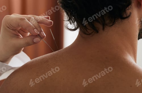 Preview: Reflexologist's hand with acupuncture needle close-up while insert needle into man's shoulder