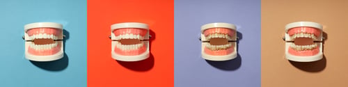Preview: Collage of photos for Teeth care concept