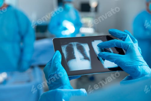Preview: Doctor wearing surgical gloves looking at lung x-ray on tablet