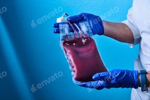 Preview: Scientist wear blue gloves hand holding red blood bag from donor at blood bank laboratory