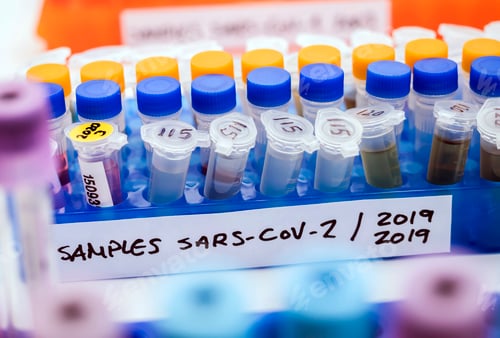 Preview: Vials with samples of SARS-COV-2 Covid-19 in a research laboratory, conceptual image