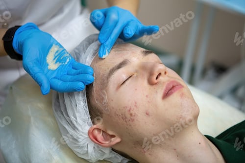 Preview: A young Caucasian teenage boy has a cosmetologist cleaning his face. A dermatologist treats acne on