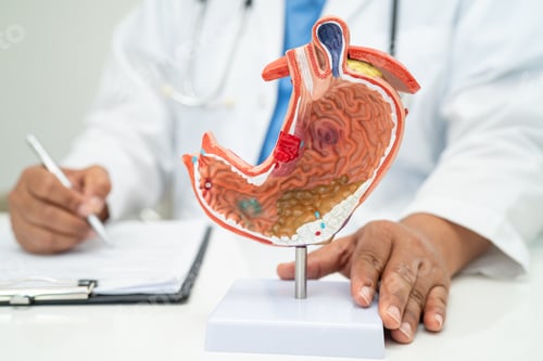 Preview: Stomach disease, doctor with human anatomy model for study diagnosis and treatment in hospital.