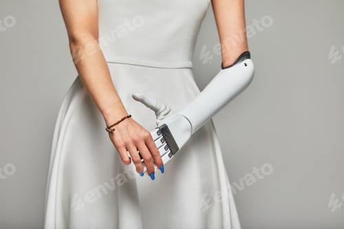 Preview: Cropped studio portrait of young girl in white dress wearing sensory bionic prosthetic arm. Slender