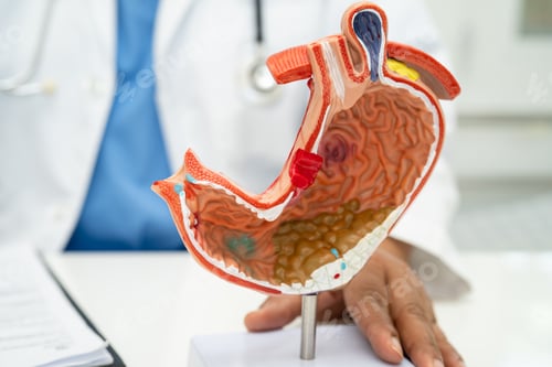 Preview: Stomach disease, doctor holding anatomy model for study diagnosis and treatment in hospital.
