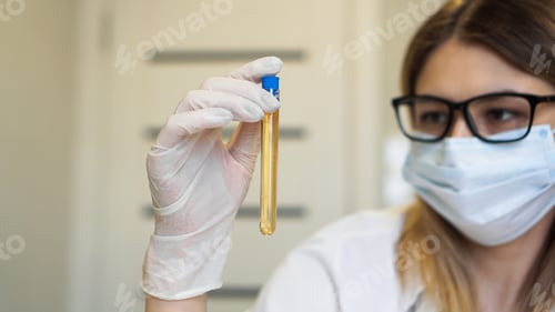 Preview: A woman holds a test tube with a urine test. Diagnostics and analysis concept