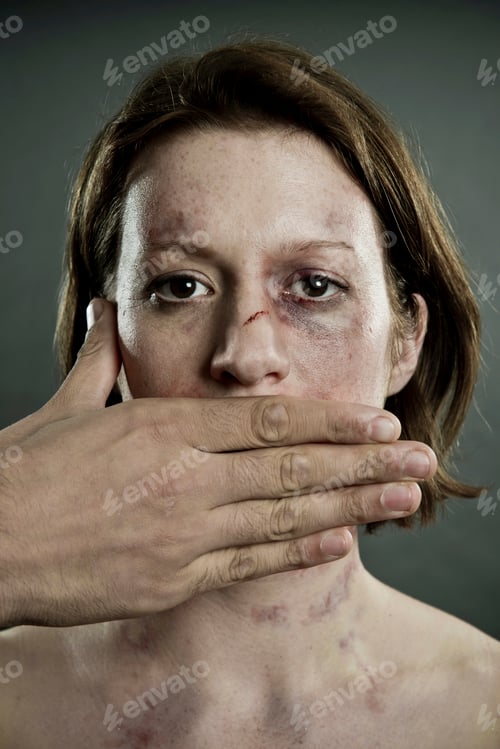Preview: Woman with bruises and mouth covered