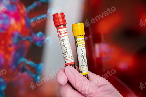 Preview: Closeup shot of laboratory sample of blood testing for diagnosis new Coronavirus infection