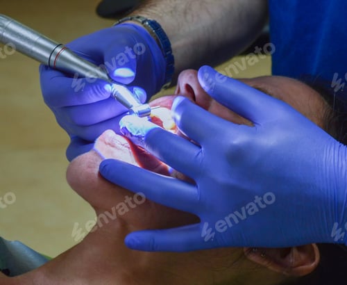 Preview: Open mouth during dental examination in a clinic