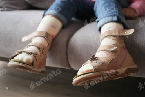 Preview: Child cerebral palsy disability, legs orthosis.