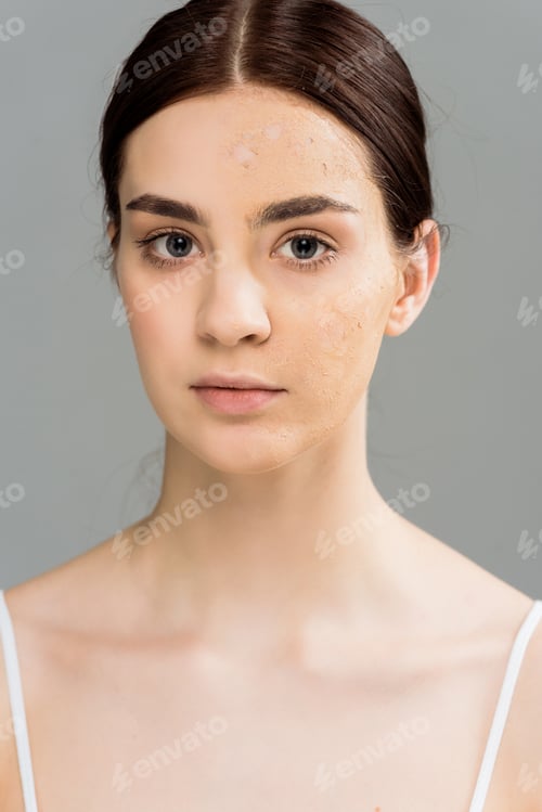 Preview: brunette young woman with problem skin looking at camera isolated on grey