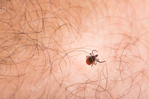 Preview: Tick - parasitic arachnid blood-sucking carrier of various disea