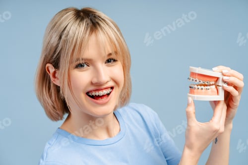 Preview: Happy cute young woman with dental braces on teeth holding plastic model human jar with braces