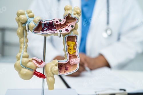 Preview: Intestine, appendix and digestive system, doctor holding anatomy model