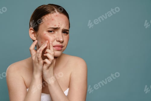 Preview: Ginger young woman wearing towel squeezing pimple on her face