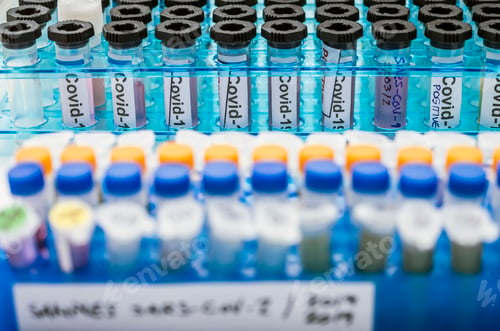 Preview: Vials with samples of SARS-COV-2 Covid-19 in a research laboratory, conceptual image