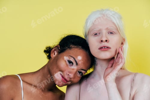 Preview: Group of multiethnic women