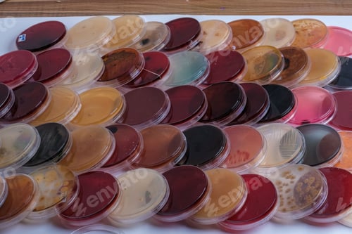 Preview: Petri dishes with agar and bacteria cultures in a lab.
