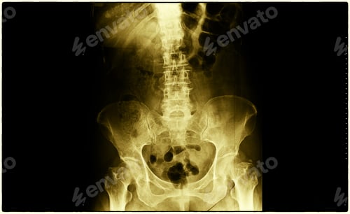 Preview: X-Ray film scan of human.
