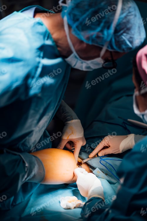 Preview: Surgeons and nurse during a foot surgery