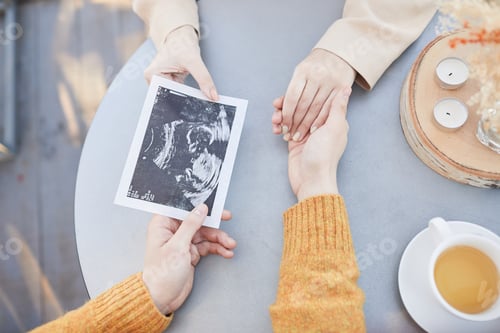 Preview: First ultrasound of the baby