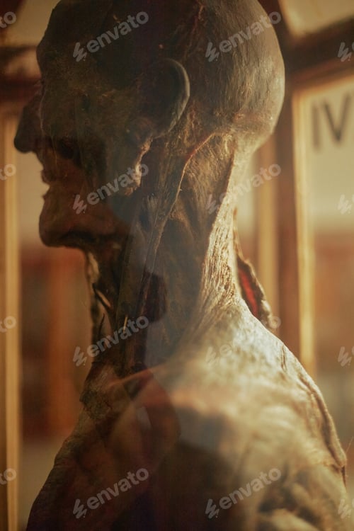 Preview: Preserved Human Cadaver Displaying Muscular Anatomy in Medical Exhibit