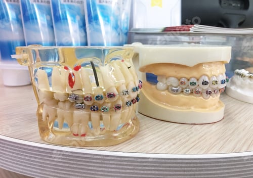 Preview: Dental teeth model