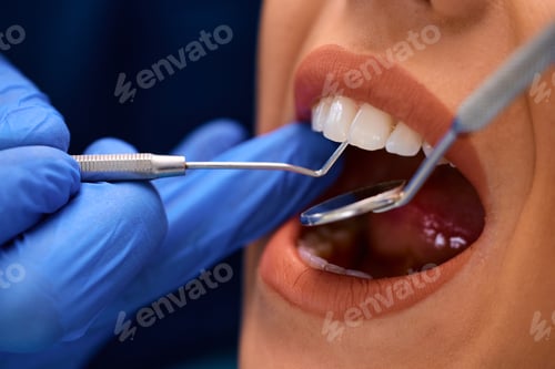 Preview: Close up of woman having teeth examination at dentist's office.